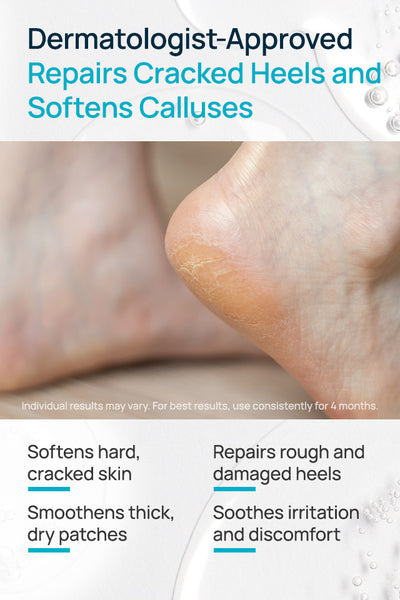 20% Urea Cracked Heel Roll-On