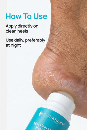 20% Urea Cracked Heel Roll-On With 20% Urea & Lactic Acid