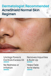 AcneShield Normal Skin Regimen With Cleanser & Moisturizer