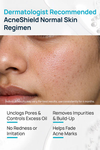 AcneShield Normal Skin Regimen With Cleanser & Moisturizer