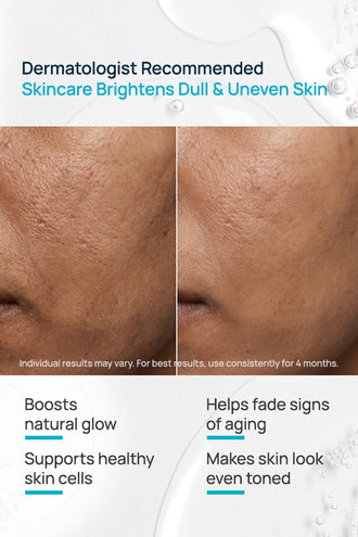 BrightSide Glow Regimen With Serum & Moisturizer